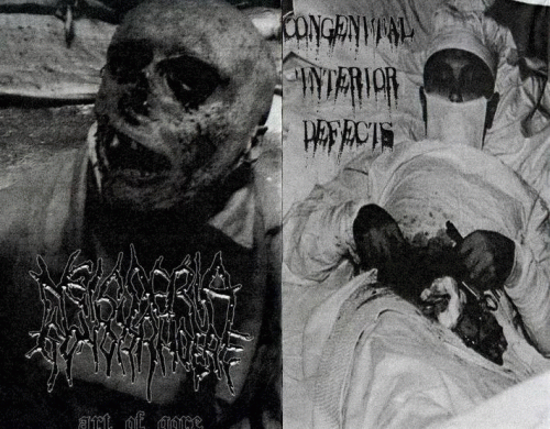 Congenital Interior Defects : Neisseria Gonorrhoeae - Congenital Interior Defects